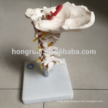 ISO Cervical Spine Model with Neck Artery